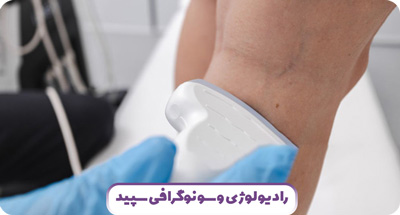 سونوگرافی واریس در مشهد